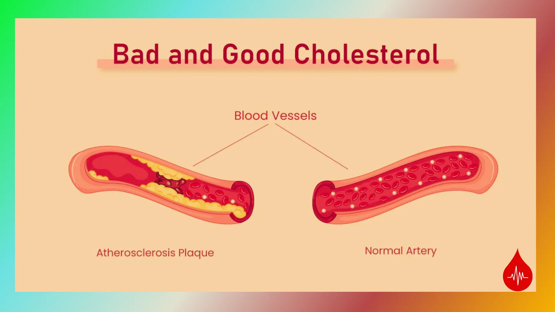 Good-and-bad-cholestrol