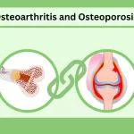 Osteoarthritis and Osteoporosis