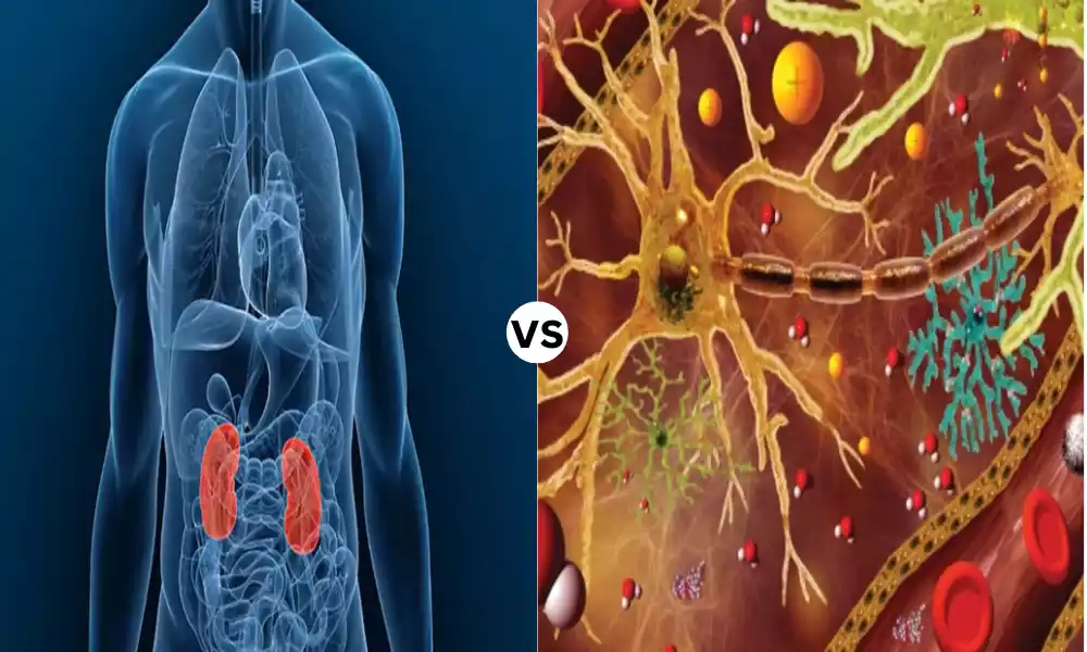 Hypernatremia and Hyponatremia