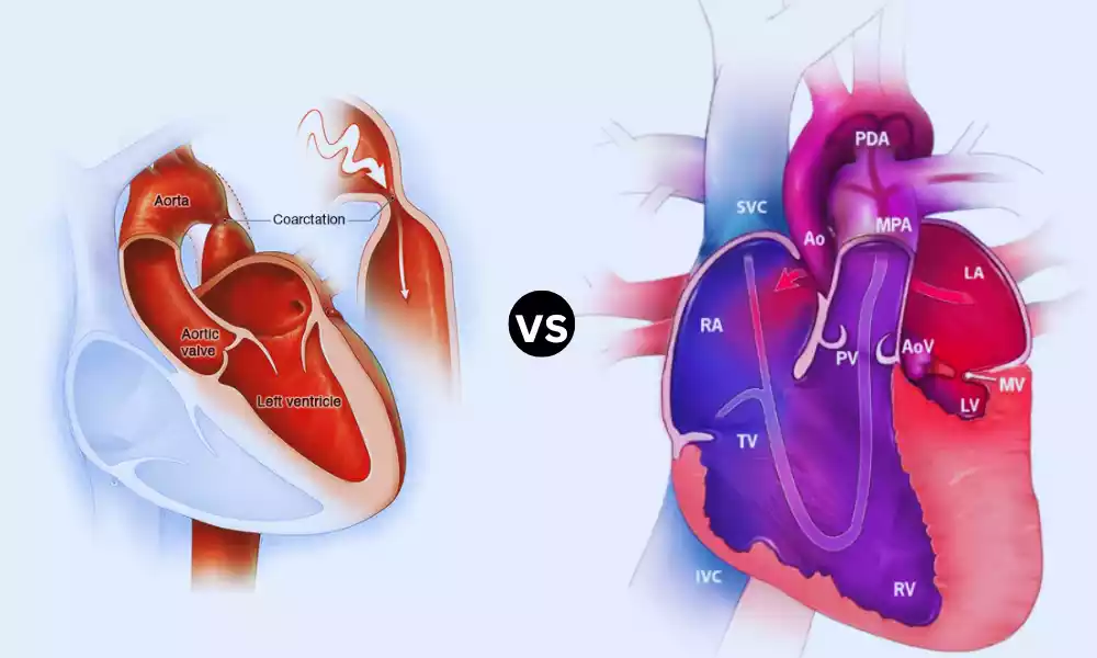 Coarctation and Hypoplastic Aortic Arch