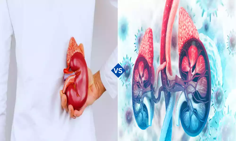 Conn's Syndrome and Pheochromocytoma