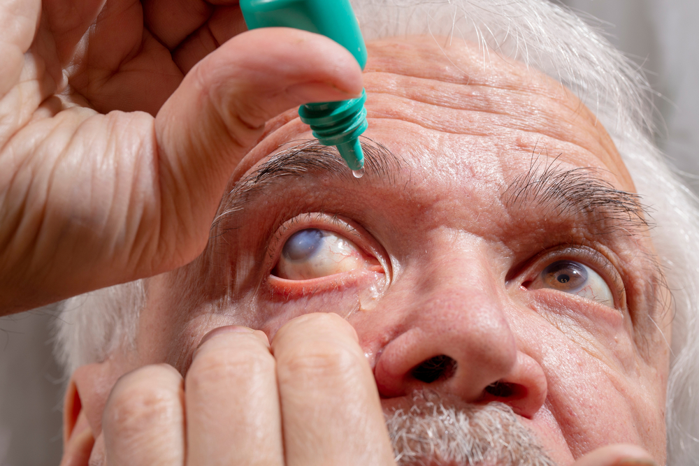 Treatment Approaches for Glaucoma and Ocular Hypertension